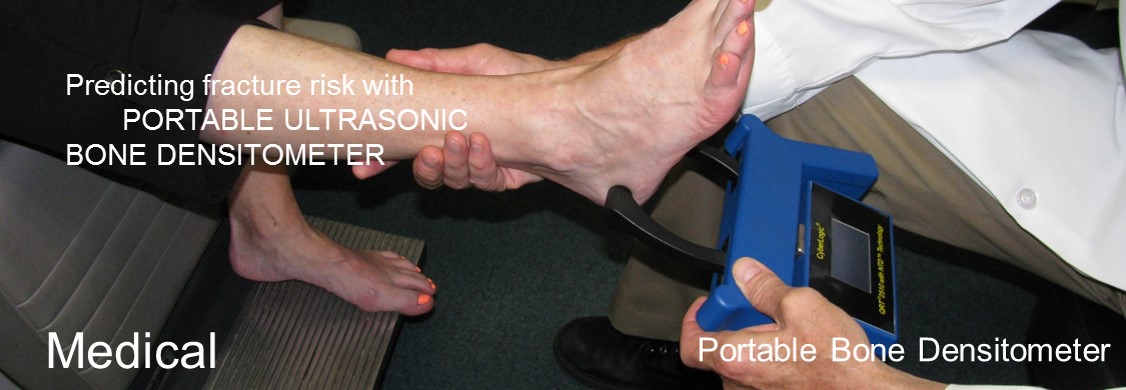 Portable bone densitometer by CyberLogic